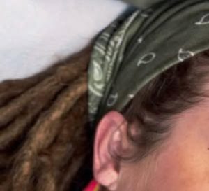 before and after brow tattoo iron deficiency