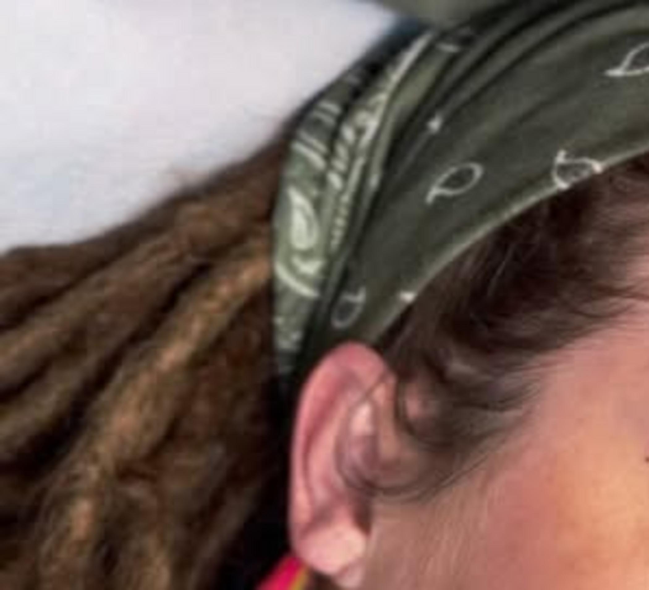 before and after brow tattoo iron deficiency