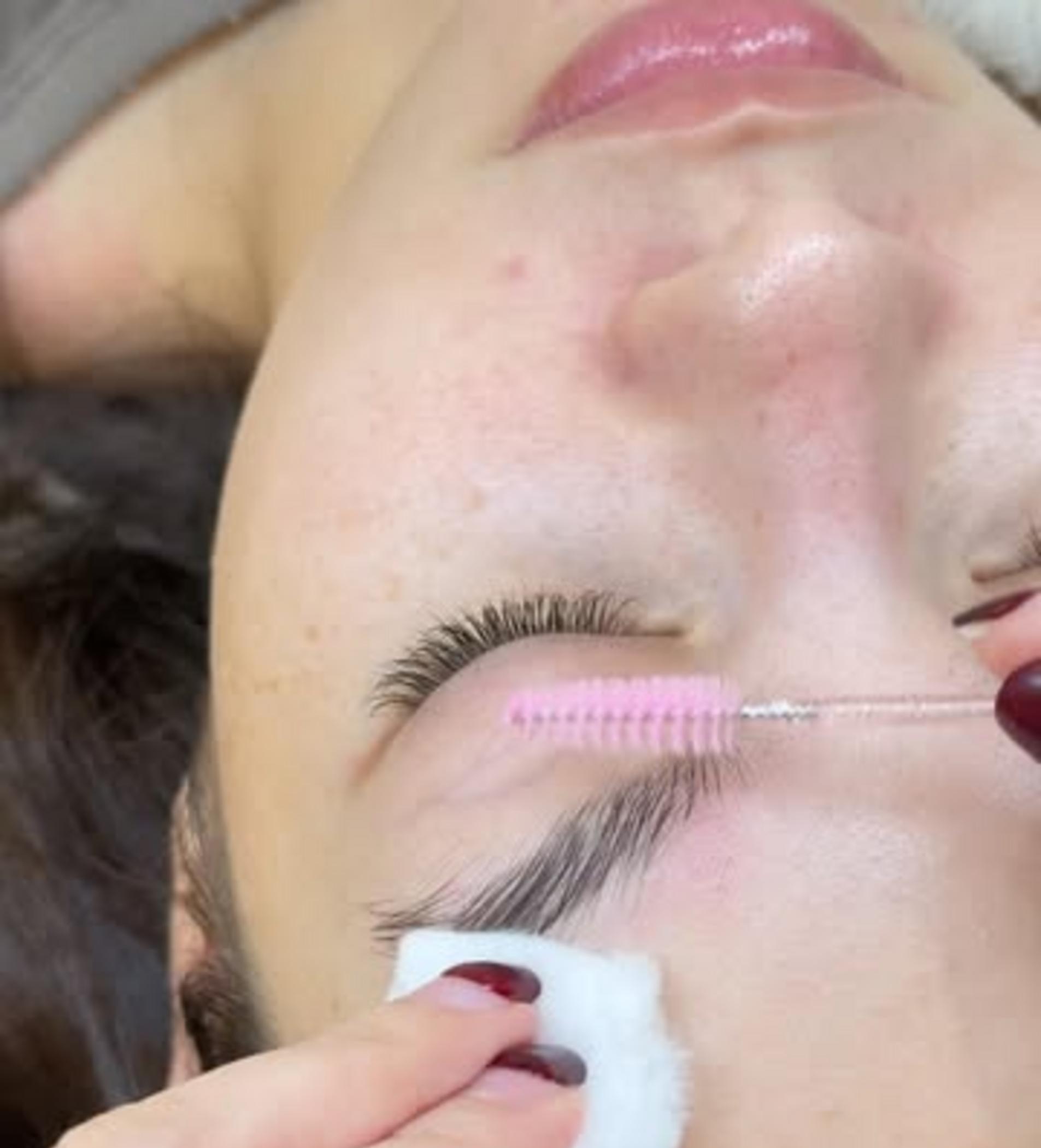 close up eyebrow pigment yellowing diabetes