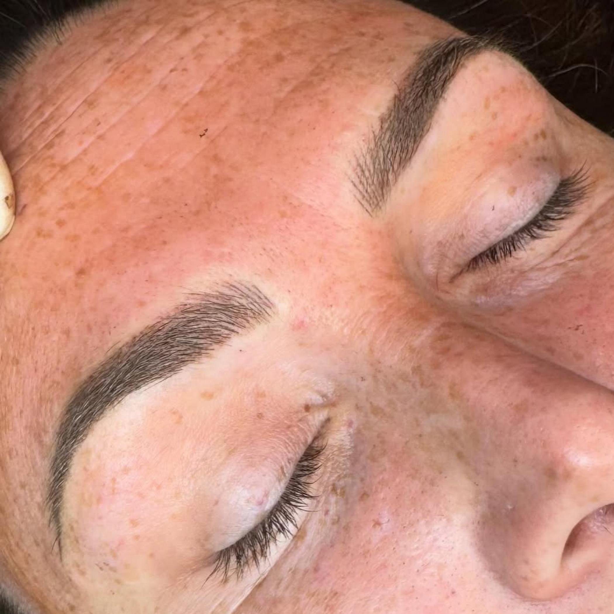 healing stages of brow tattoo diabetes