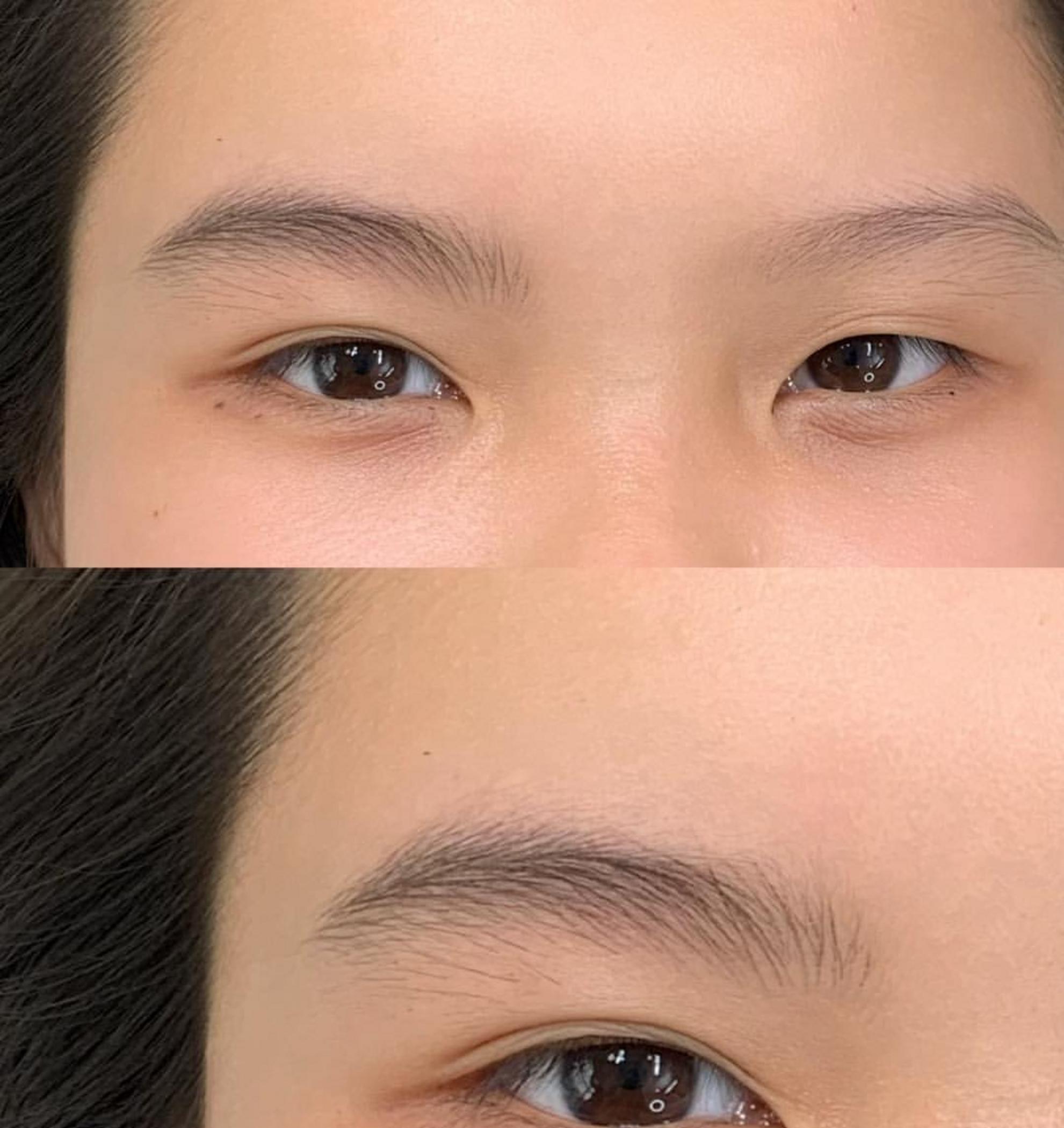 microblading procedure on diabetic skin