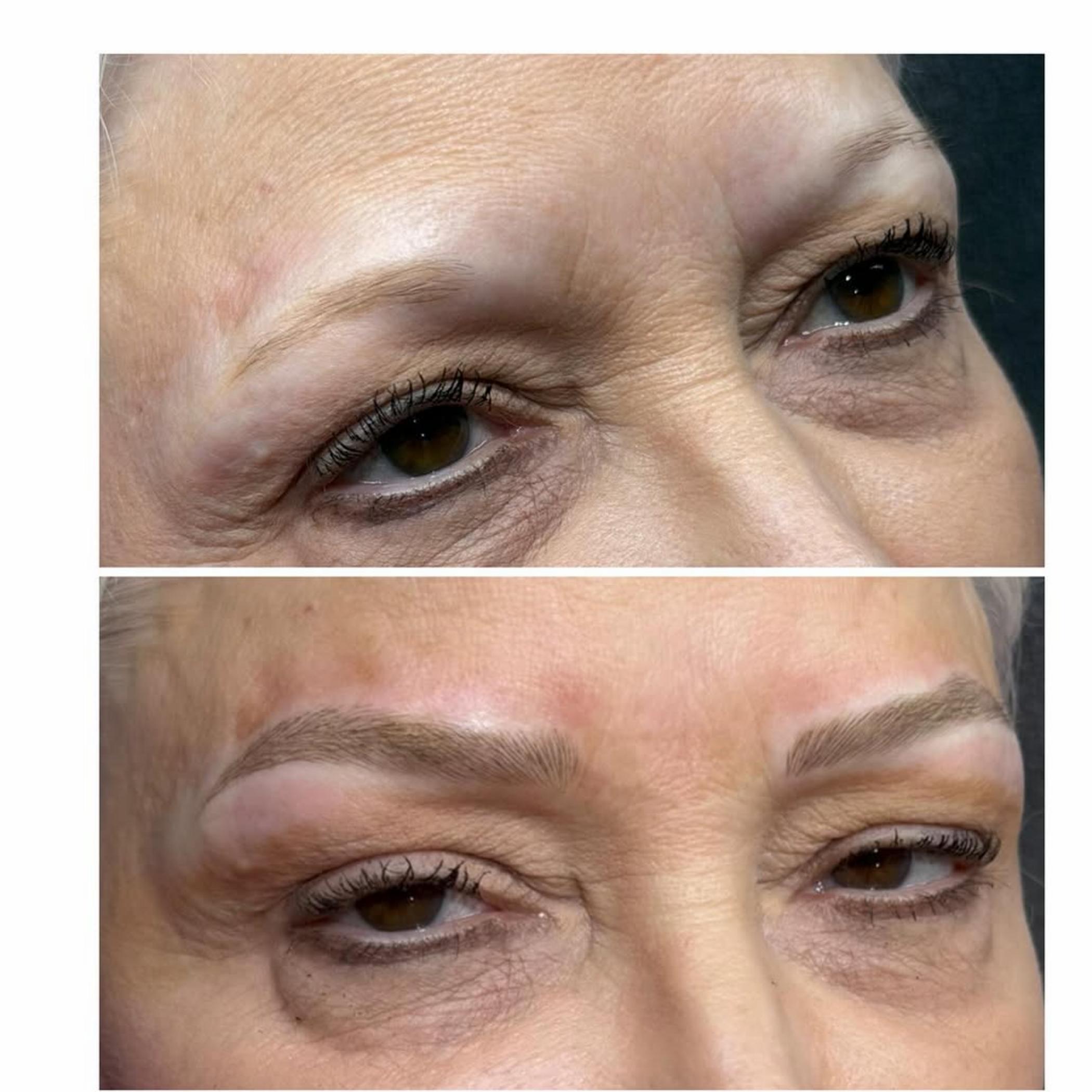 natural eyebrow tattoo results diabetes
