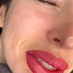 Saline Vs Alkaline Microblading Removal