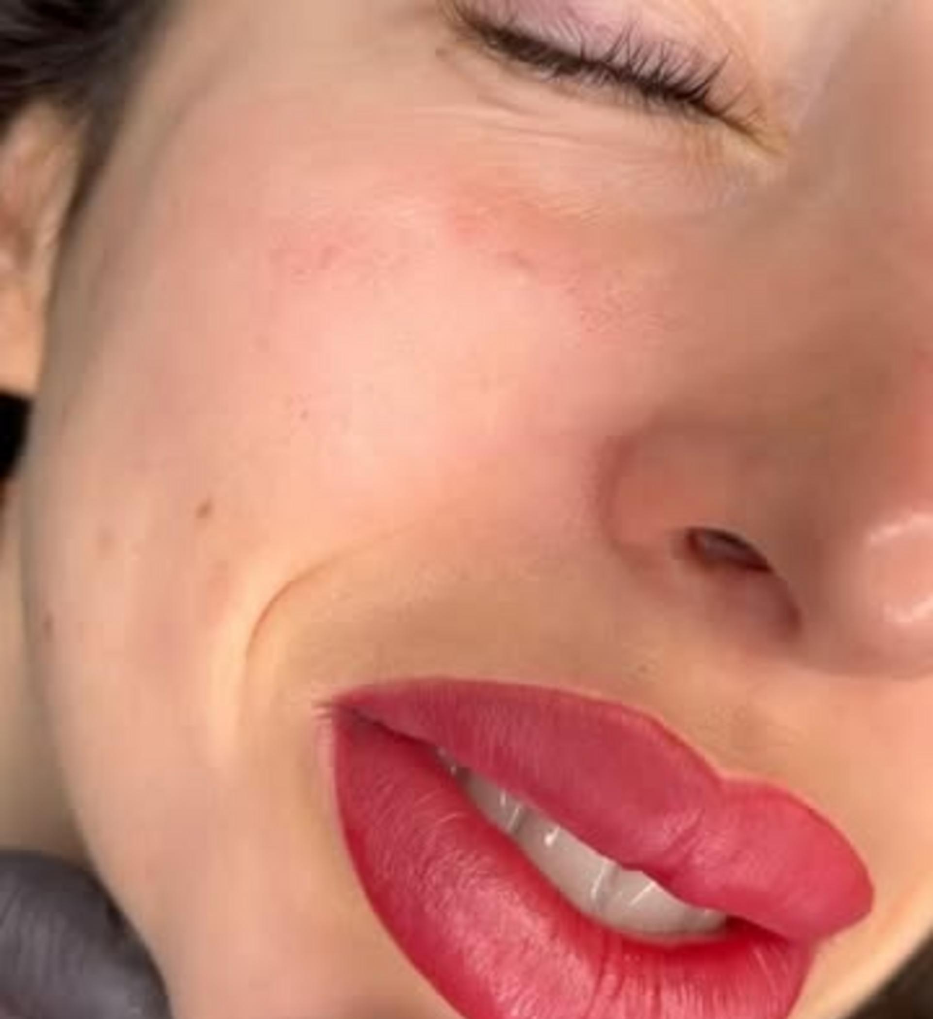 saline microblading removal before after